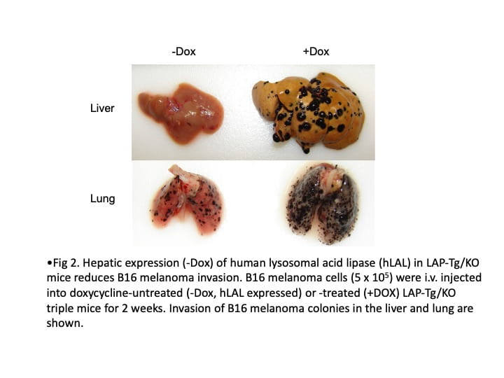 Comparative images of liver and lung tissues from mice treated with or without doxycycline (-Dox and +Dox), showing differences in B16 melanoma invasion. Tissues with doxycycline treatment exhibit numerous black melanoma colonies, while untreated tissues show fewer invasions.