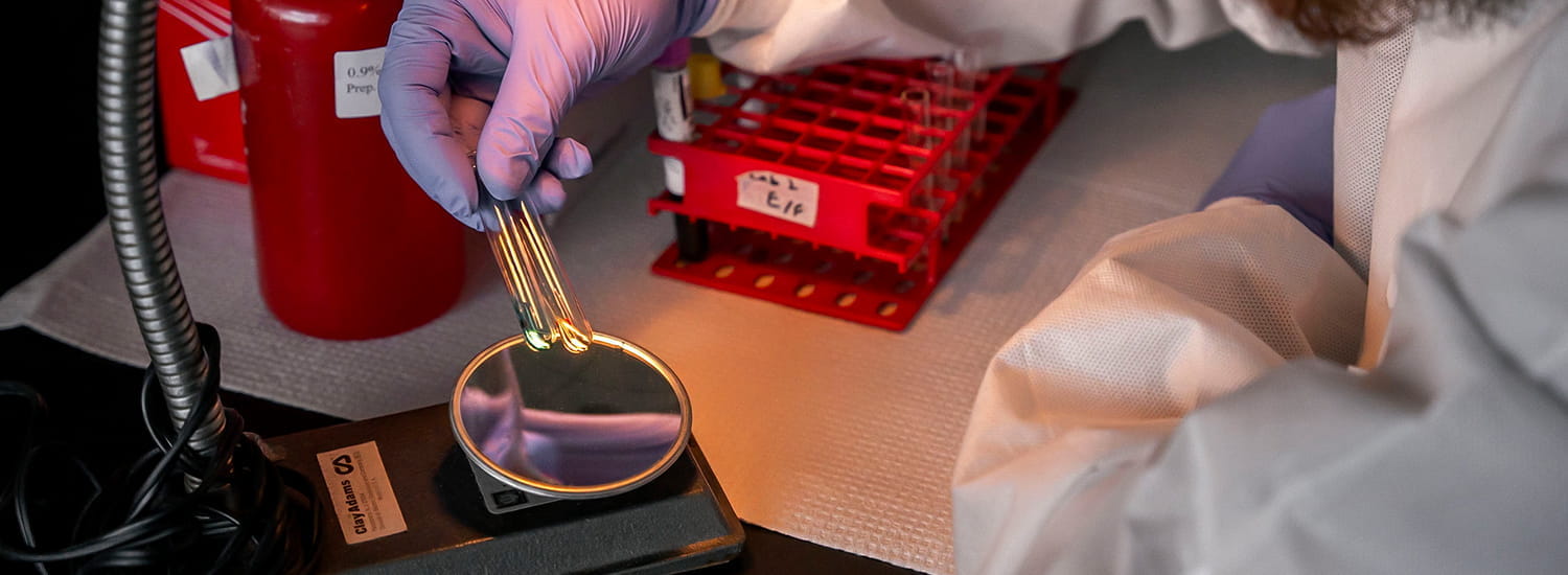 A gloved hand carefully holds a set of inoculation loops over a petri dish, with lab equipment in the background. The scene captures the precision and attention to detail required in the lab, where each tool plays a crucial role in ensuring accurate sample handling and analysis.