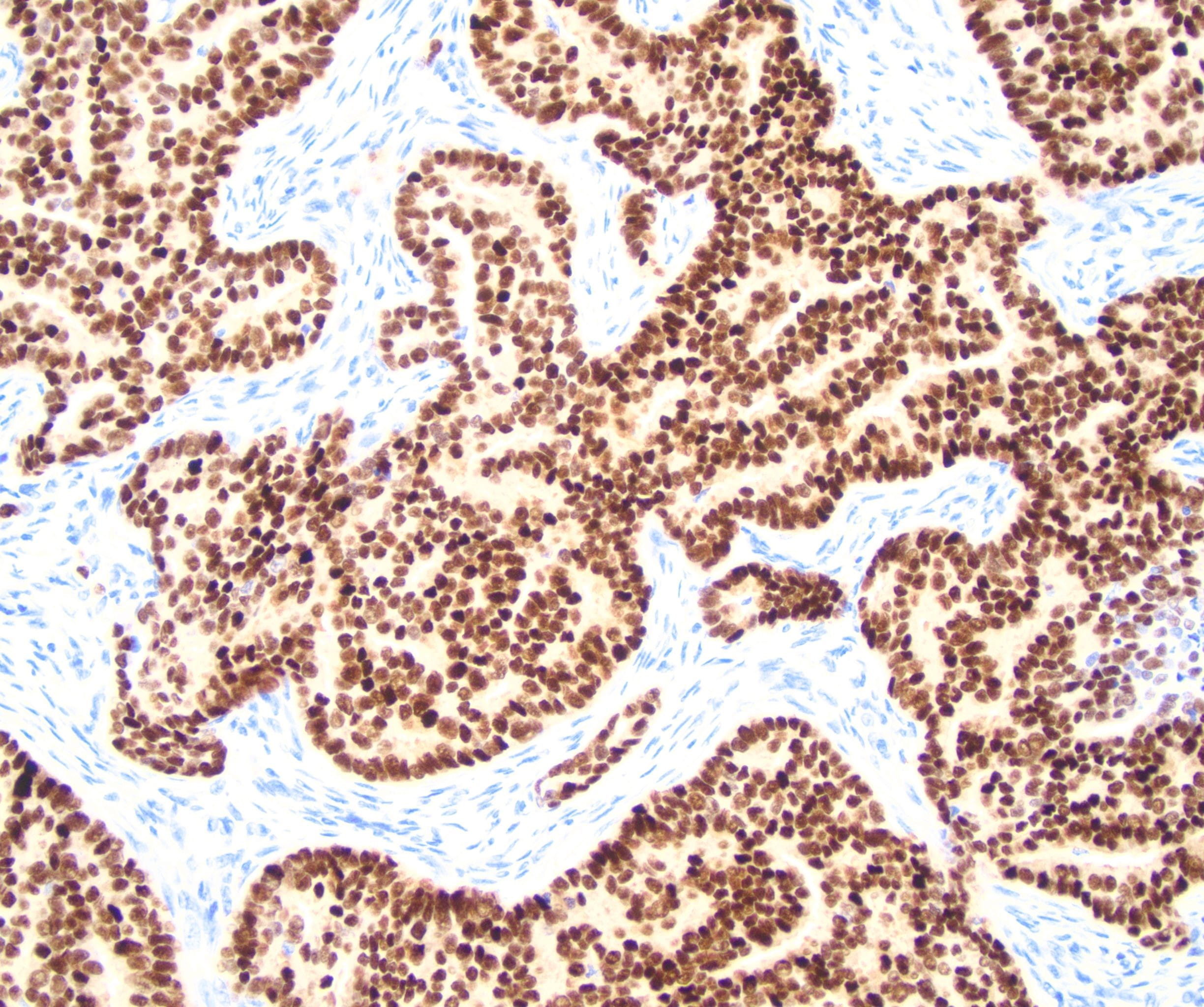 immunohistochemistry sample with blue and brown dots