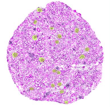 imaging shows glomeruli in a renal biopsy