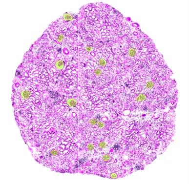 imaging shows glomeruli in a renal biopsy