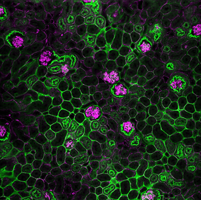 green and purple imaging scan