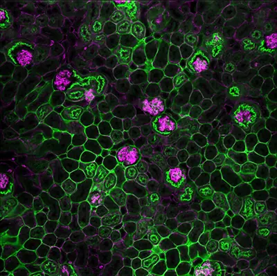 green and purple imaging scan