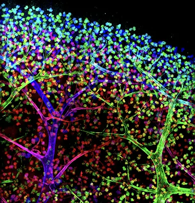glomeruli kidney imaging in blue, purple and green