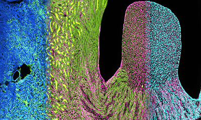 imaging scan in blue, yellow and pink