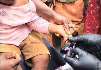 Up close view of gloved hands pricking the finger of a young child