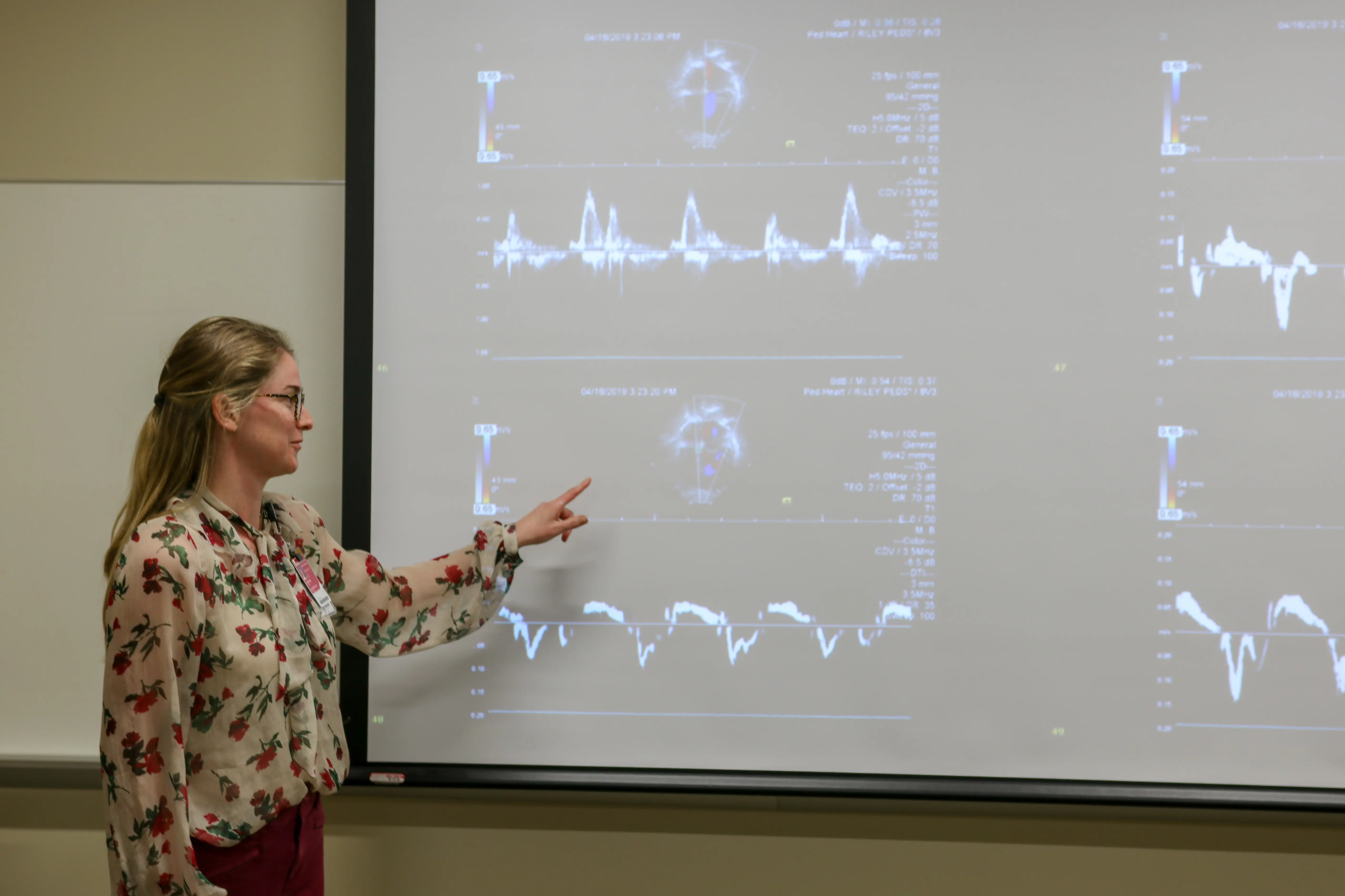 Laura Shopp, MD, fellow in pediatric cardiology teaches the other fellows about echocardiography
