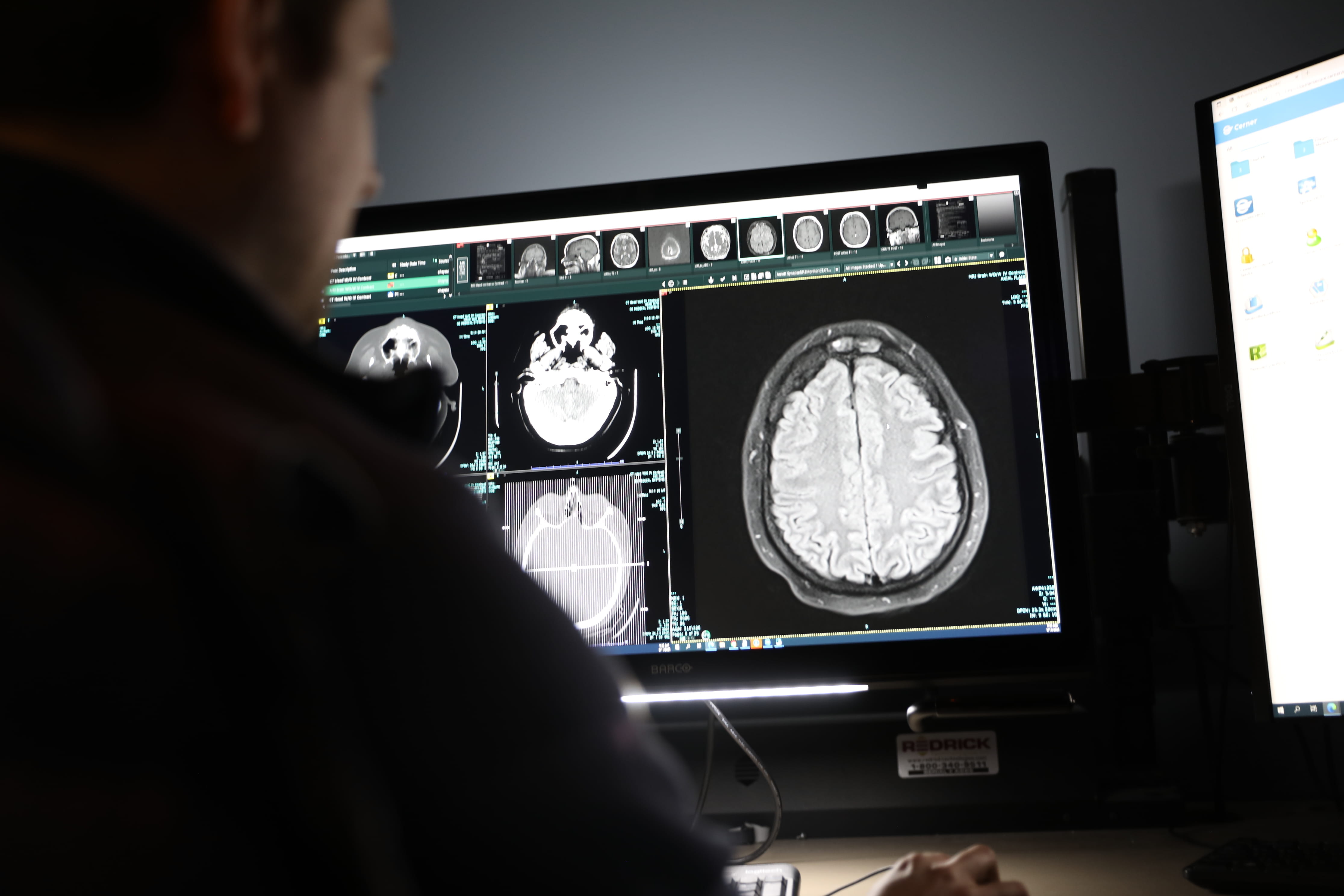 A male radiologist studies images of the brain.