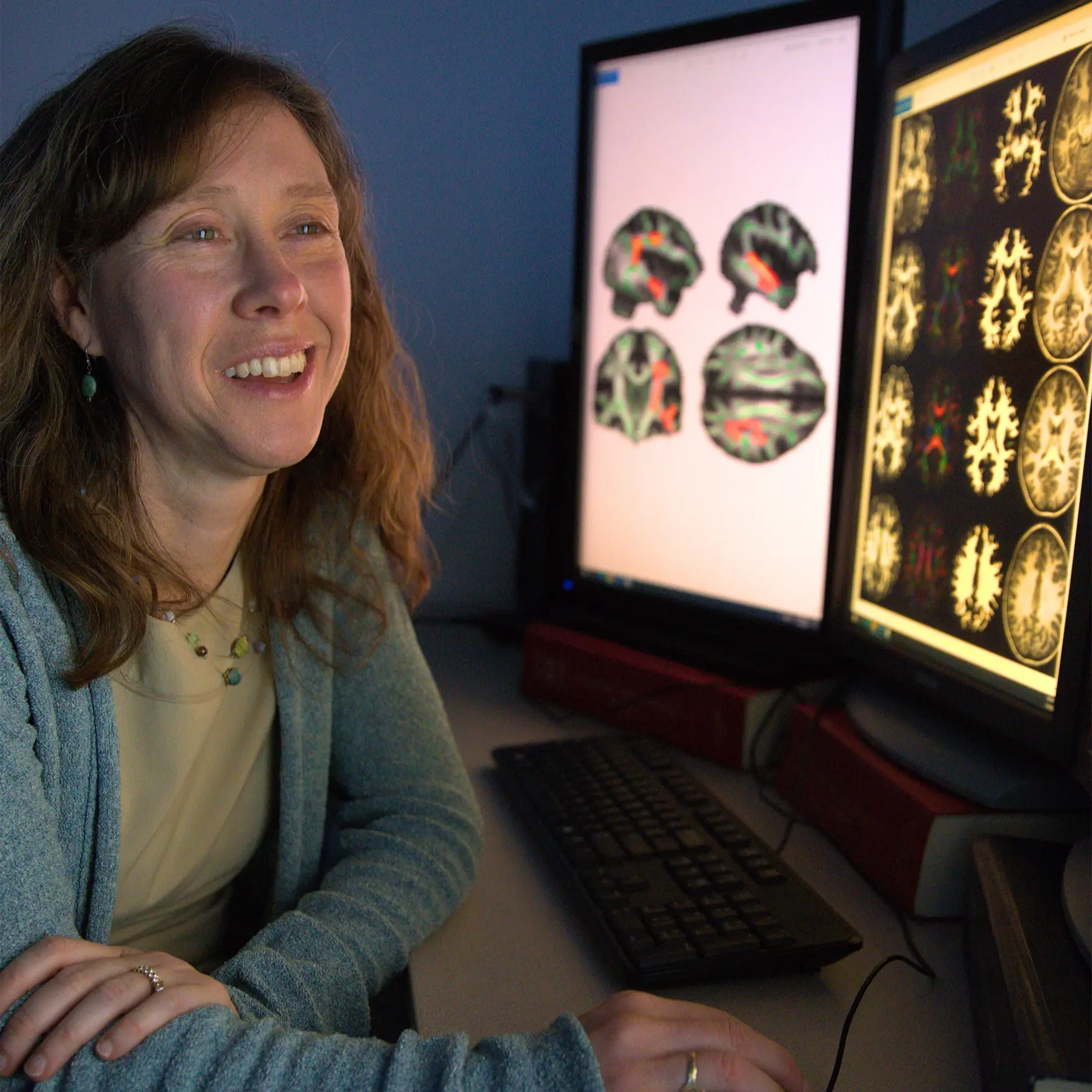 female radiologist smiling while looking at neuro scans on a monitor
