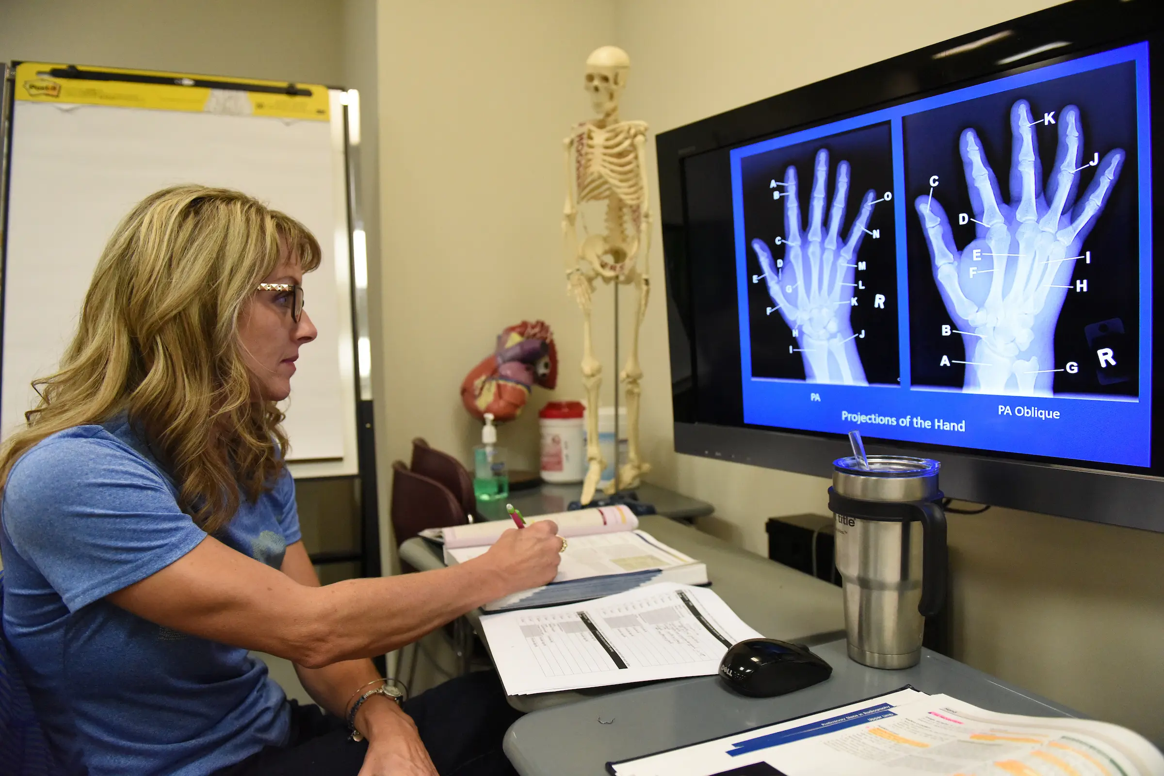 A female student studies the anatomy of a human hand.