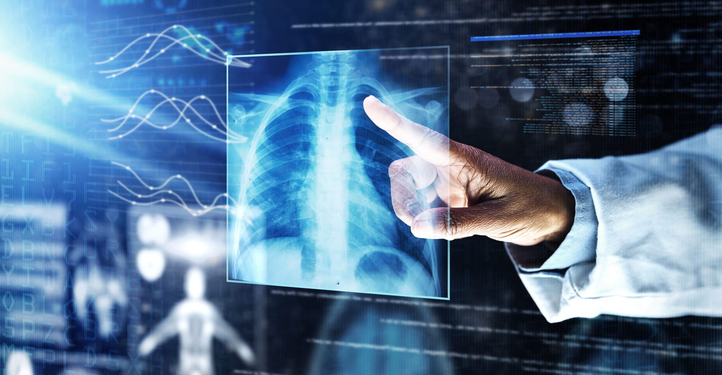 The image shows a doctor, wearing a white coat, pointing at a translucent, holographic display of a human chest X-ray. The X-ray image is of the lungs, ribs, and heart. The background is a digital interface with various graphs, data points, and code-like text. The overall impression is one of advanced medical technology, likely involving artificial intelligence or machine learning, used to analyze medical scans.