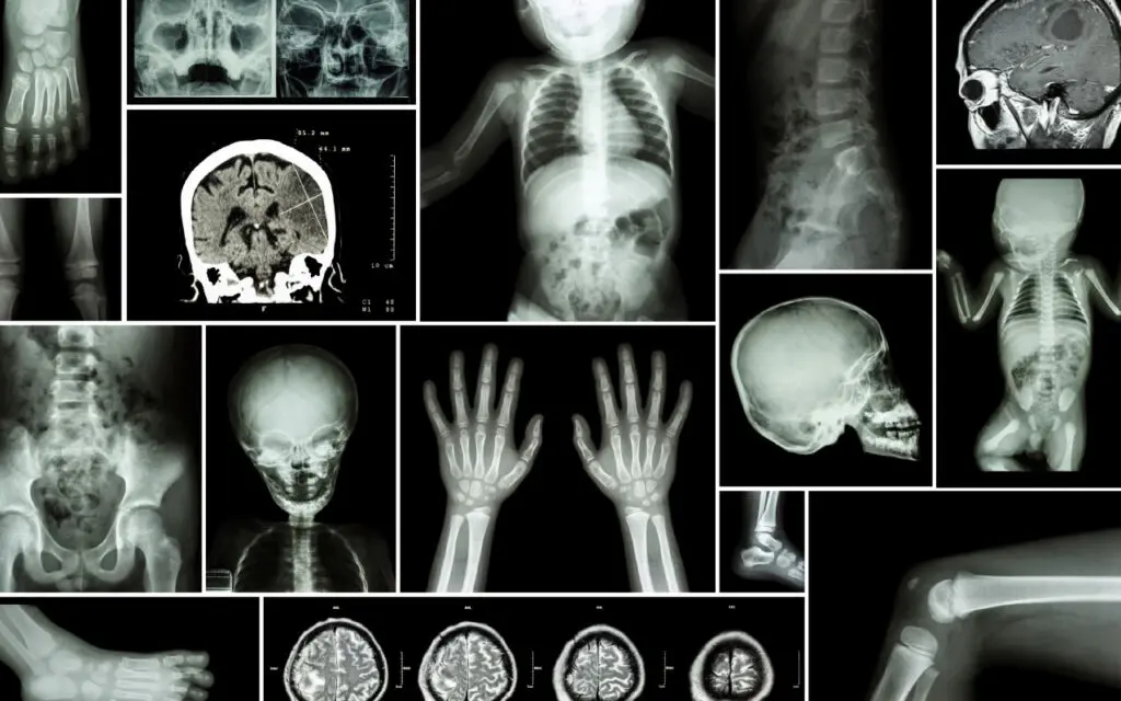 A collage of different types of pediatric scans.