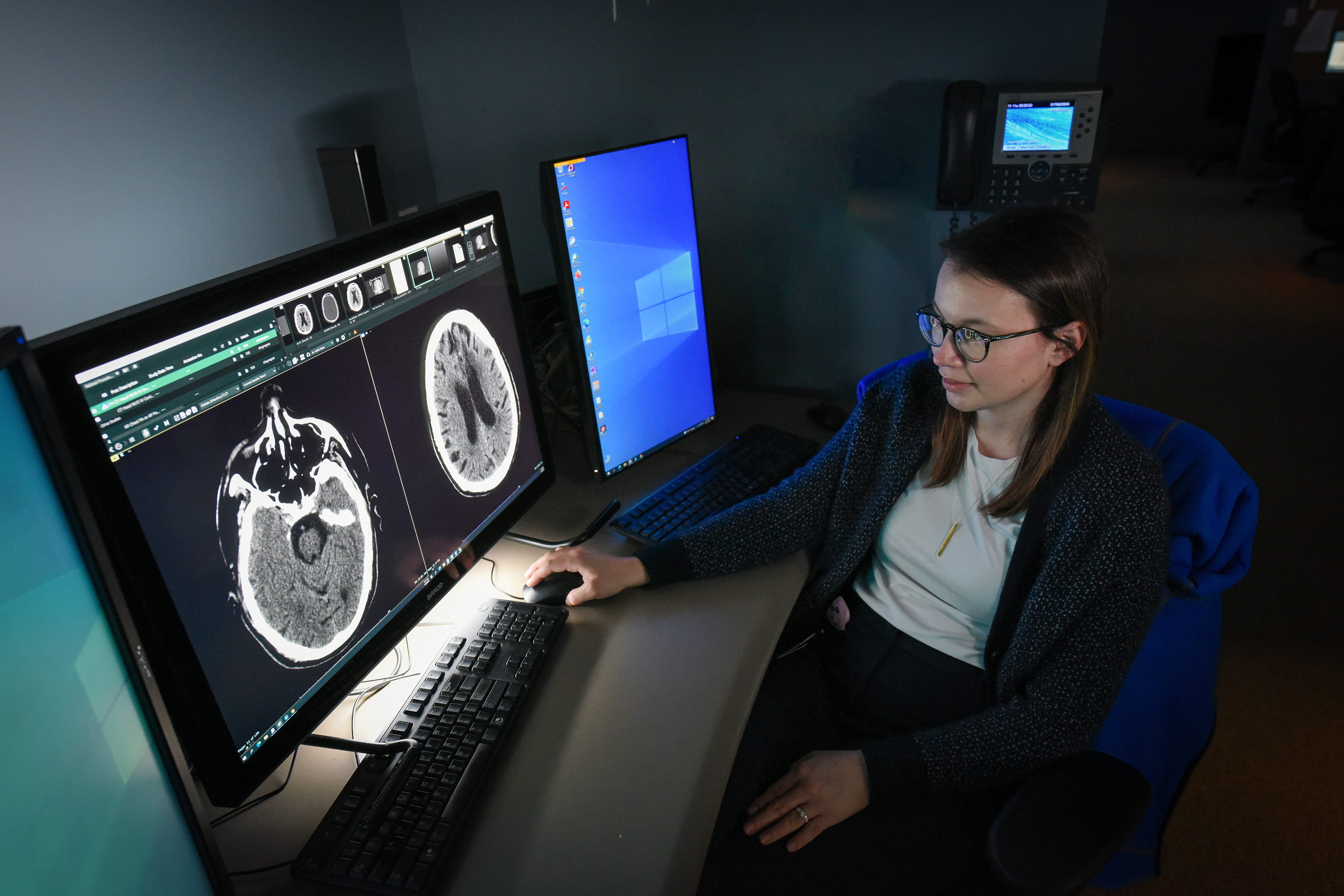 A female resident reviews neuro scans.