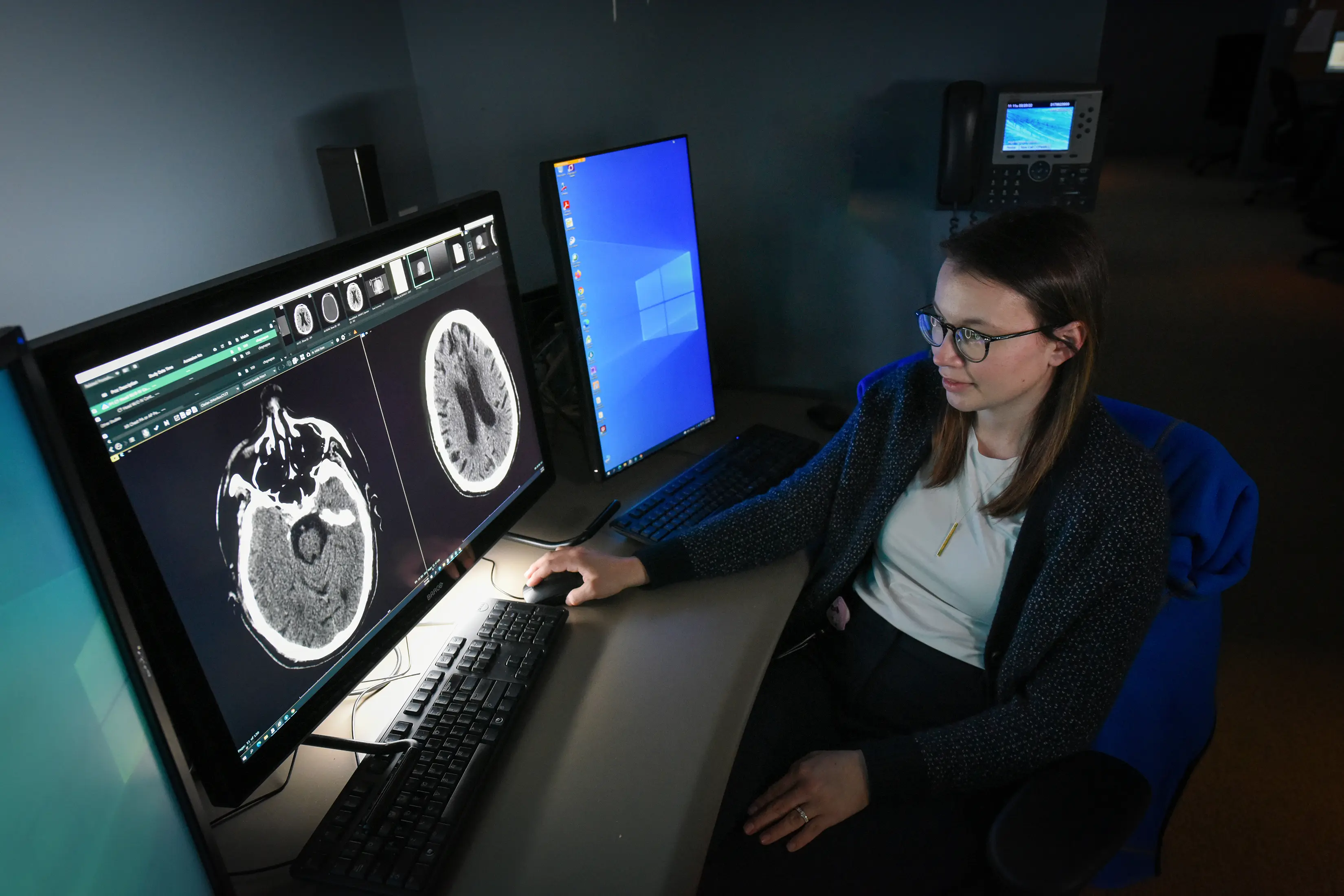A female resident reviews neuro scans.
