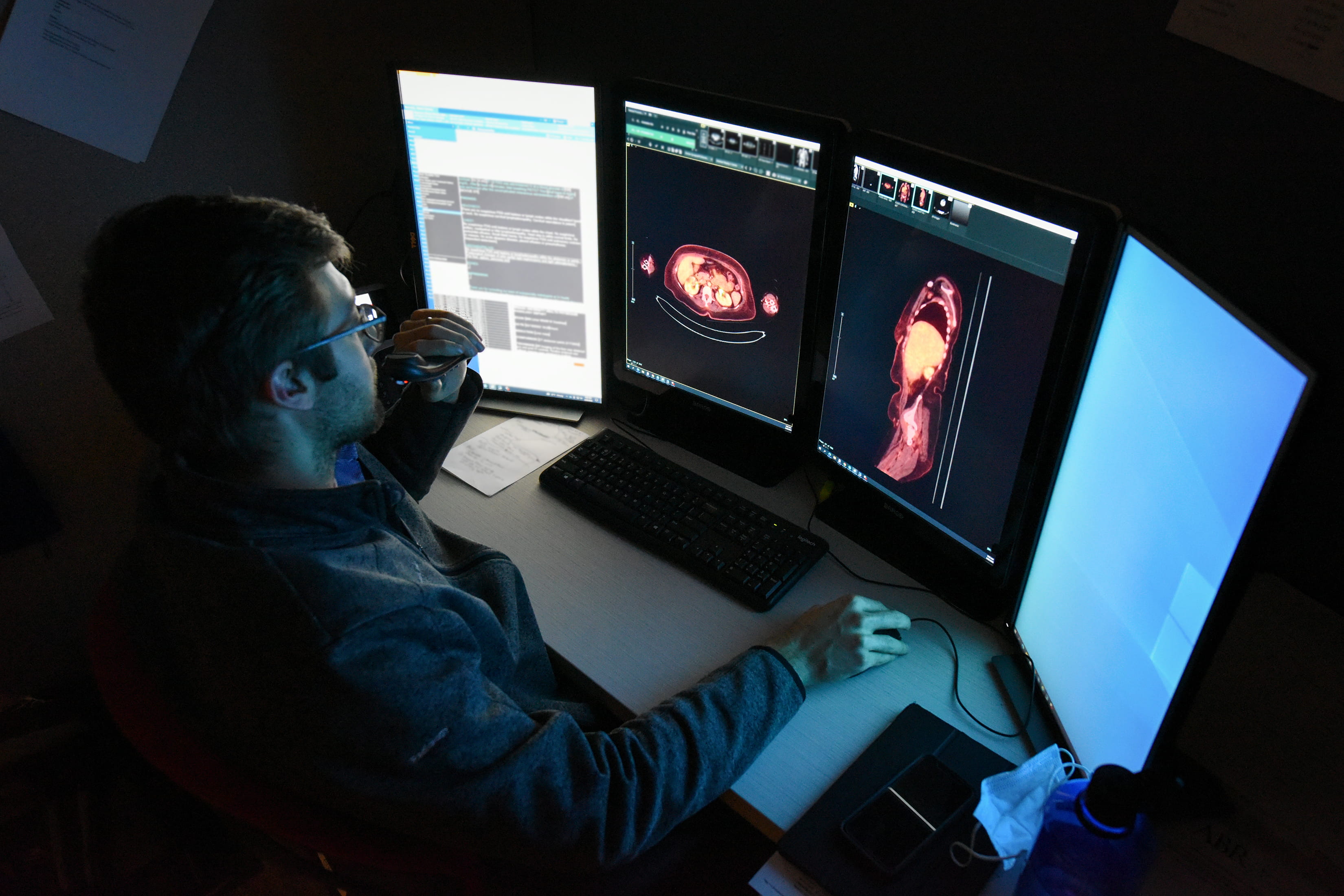 A male physician annotates a chest scan.