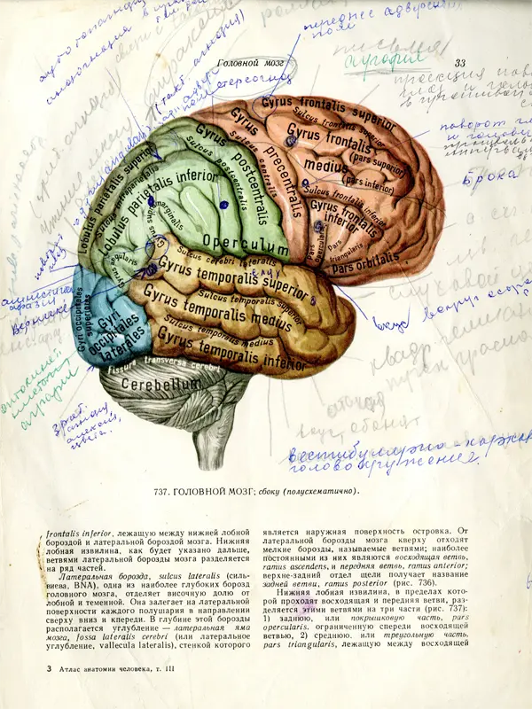 An image of brain with Russian notes