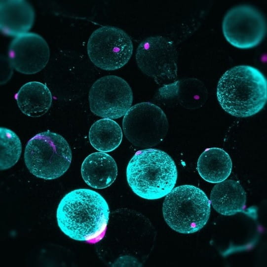 teal adipocyte blobs on a black background