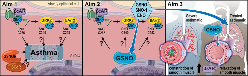 Graphic depicting the Gaston Lab's 3 Project Aims. 1: Define the role of S-nitrosylation of specific β2AR signaling components (β2AR, GRK2, β-Arrestin2). 2: Determine if drugs that elevate GSNO (SNO-donors or SNO reductase inhibitor), through actions on the pulmonary β2AR signaling system, can prevent or correct the development of airway hyper-responsiveness in a pre-clinical murine model of asthma. 3: Demonstrate that inhaled GSNO will improve both FEV1 and β2-agonist responsiveness in the severe asthma patient subpopulation.