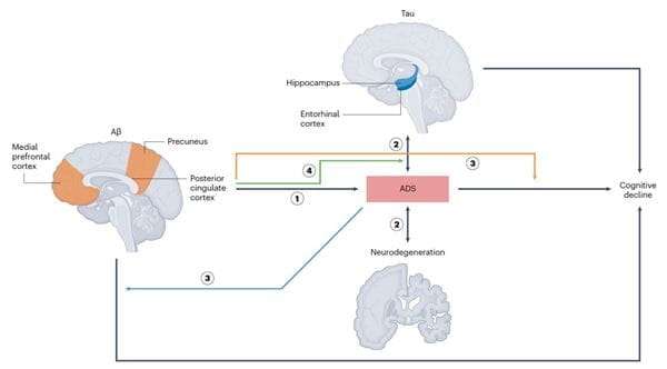 anxious-depressive symptom-facilitated alzheimer's disease progression model