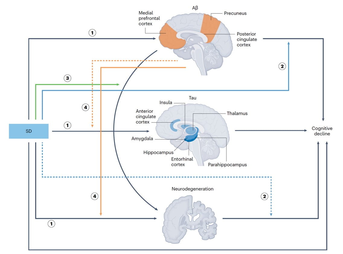 sleep disturbance-facilitated alzheimer's disease progression model
