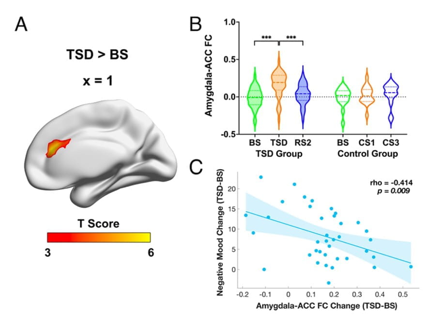 model of TSD-induced increases in amygdala–ACC connectivity and its association with mood changes from baseline to sleep deprivation in healthy individuals