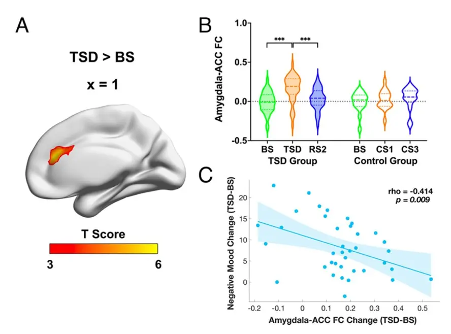 model of TSD-induced increases in amygdala–ACC connectivity and its association with mood changes from baseline to sleep deprivation in healthy individuals