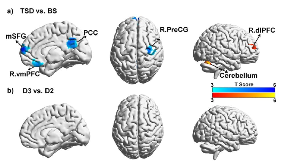 Hippocampal connectivity changes following sleep deprivation and normal sleep