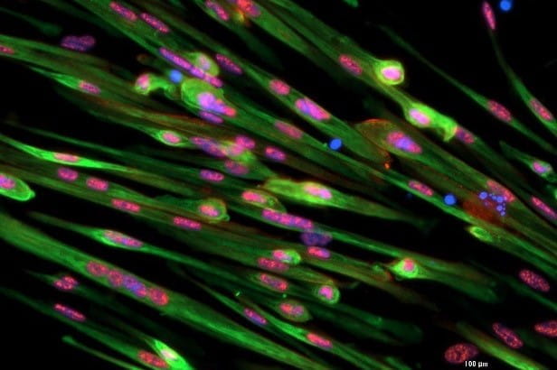 skeletal muscle regeneration imaging