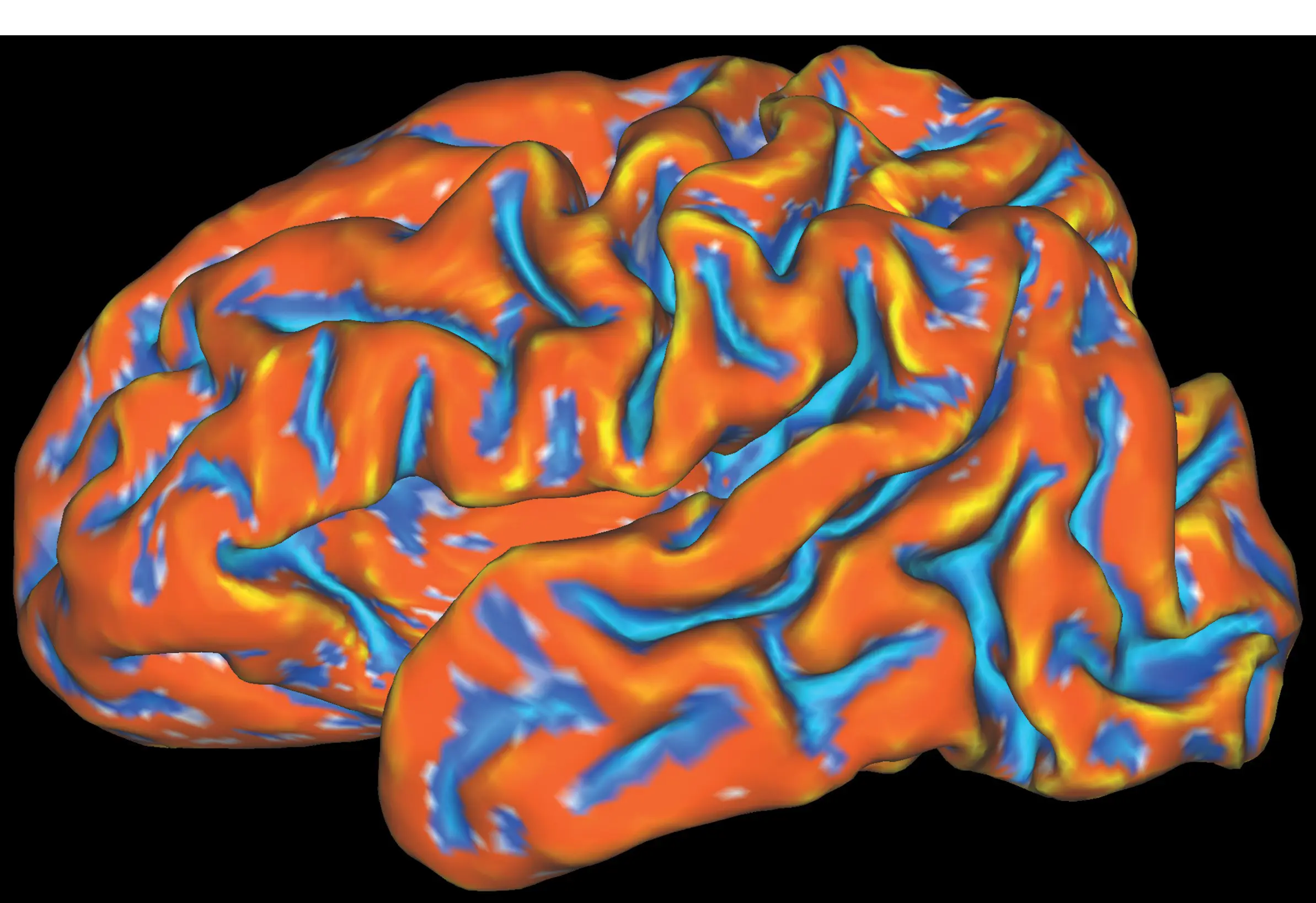 an orange and blue scan of a brain to measure cortical folding. 