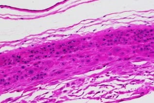 human gestational membrane immunohistochemistry H&E