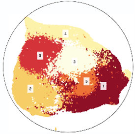 red and yellow areas seen under a microscope