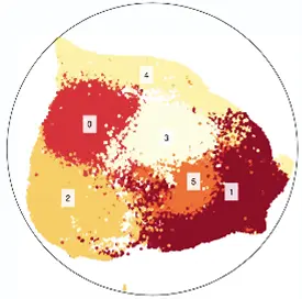 red and yellow areas seen under a microscope