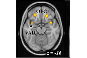 image of a brain scan