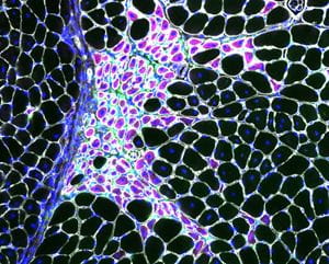 an image of macrophages in a muscle sample