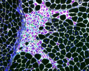 an image of macrophages in a muscle sample