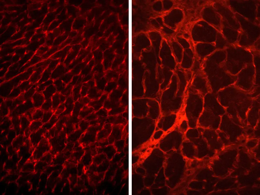image showing Pathological remodeling of the dystrophin-deficient myocardium