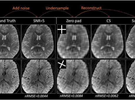 Images of brain scans.