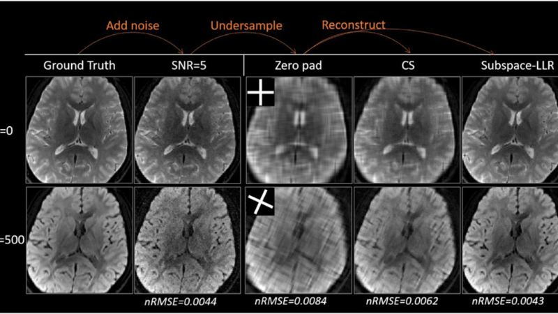 Images of brain scans.