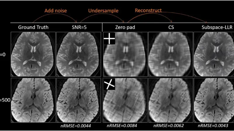 Images of brain scans.