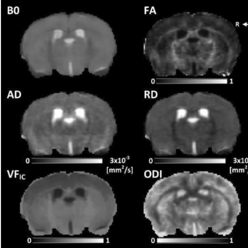 Images of six brain scans over black background.