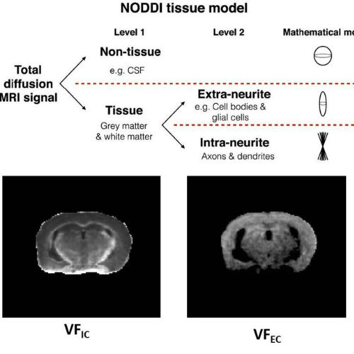 Two images of brain scans.