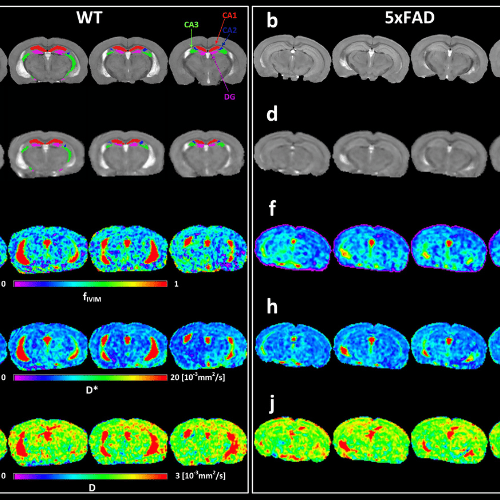 Images of brain scans in grays, blues and greens over black background.