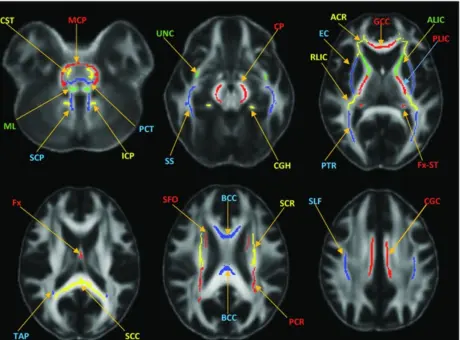 Images of brain scans for TBI.