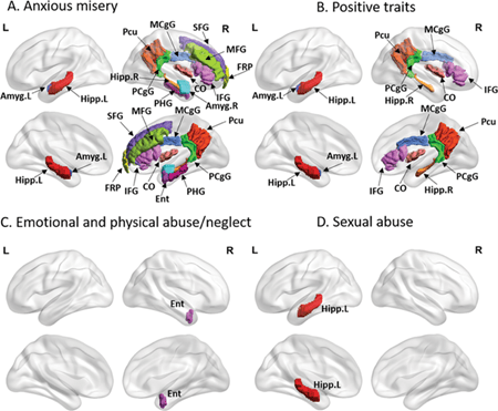 mood disorder imaging