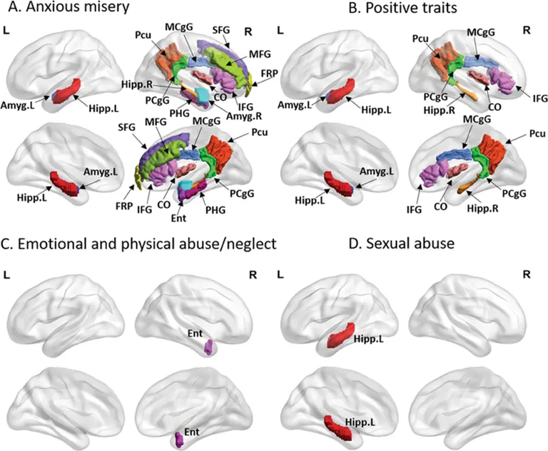 mood disorder imaging