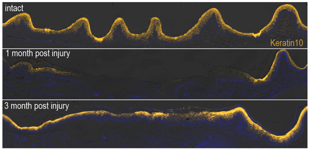 imaging shows distribution of wnt-responsive cells within the healed epithelial tissue at pre-injury, 1 month post injury and 3 months post injury.