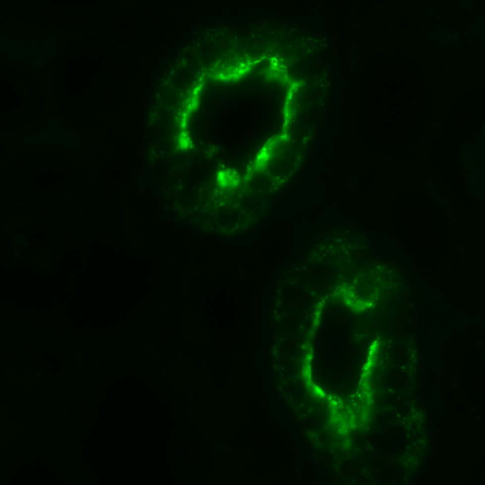 a DMBT protein in the human kidney