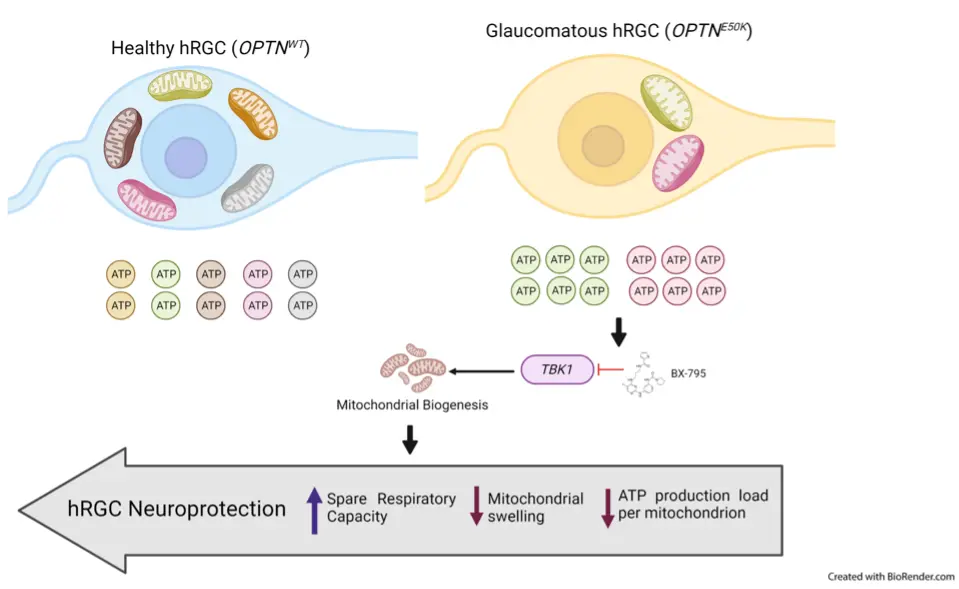 graphic showing how restoring mitochondrial homeostasis in the diseased neurons can protect the optic nerve cells from being damaged