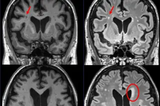 Four brain scans 