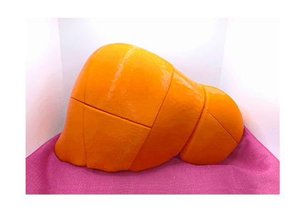 3D-printed segmented liver model (front view)